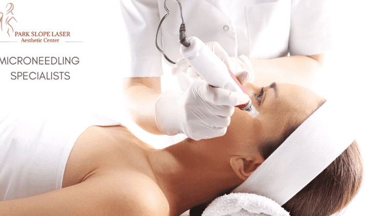 Microneedling