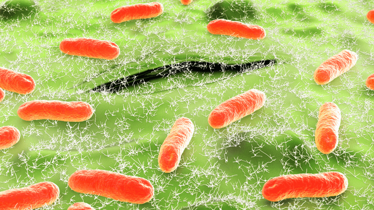 Microscopic view of orange bacteria surrounded by a green textured background.