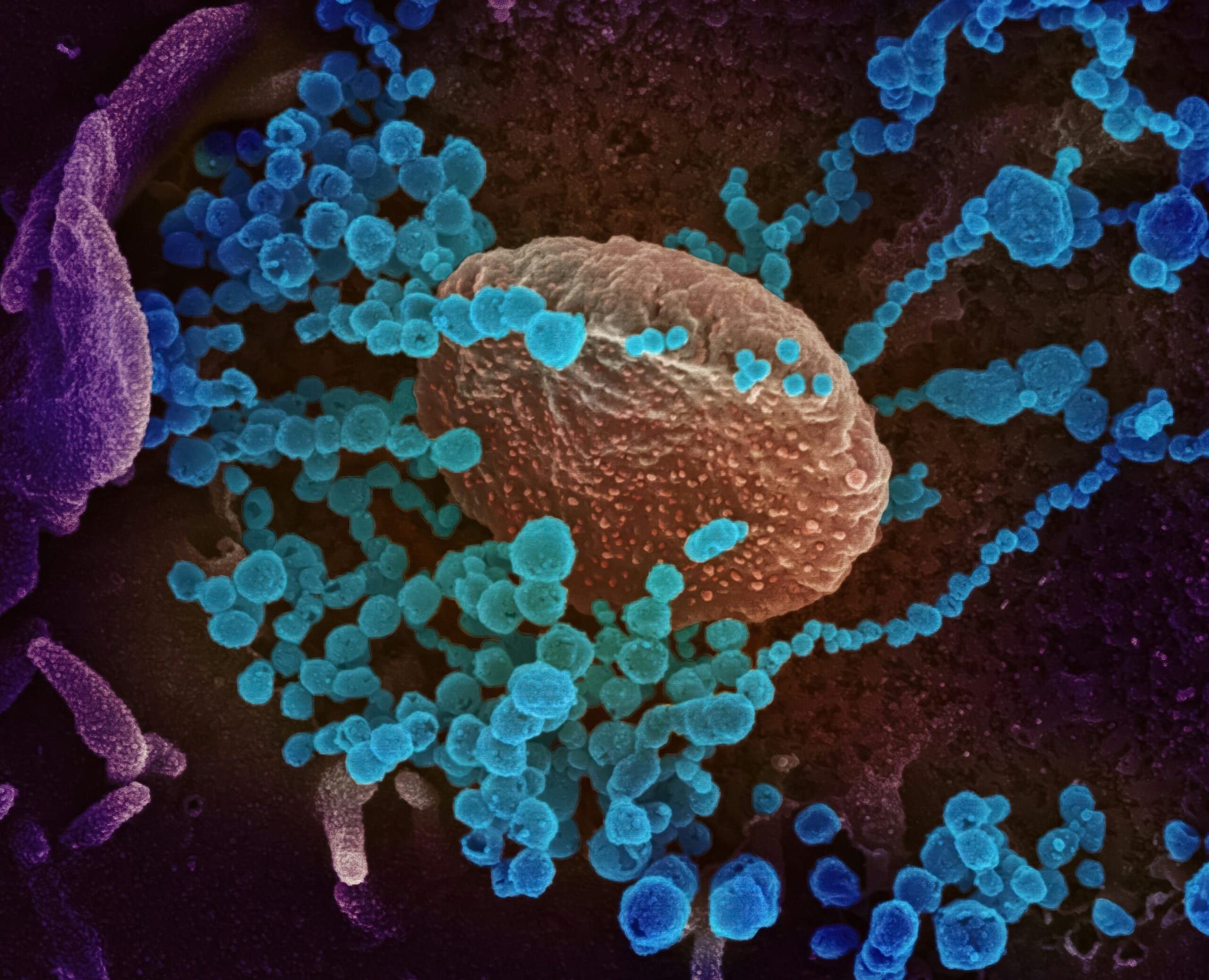 IMETELSTAT Receives Landmark FDA Approval, Ushering New Era in Telomere-Targeted Cancer Therapy