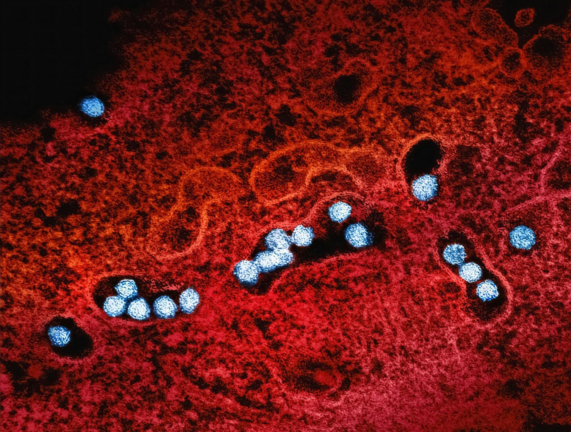 Rising Mpox Cases in the Philippines and Renewed U.S. Focus on UTI Treatment