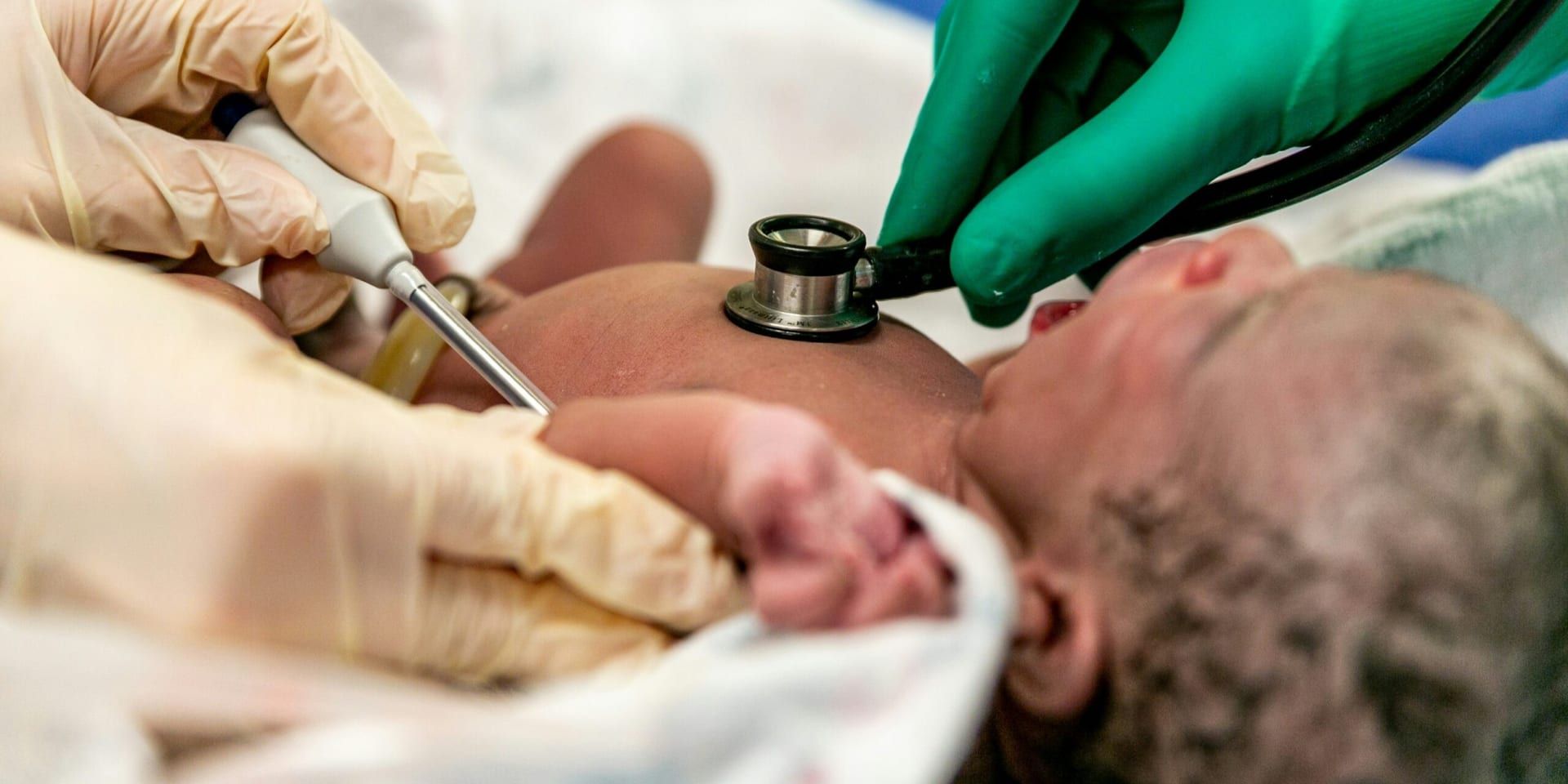 Colorado Upholds Traditional Hepatitis B Newborn Vaccination Amid Federal Advisory Shift