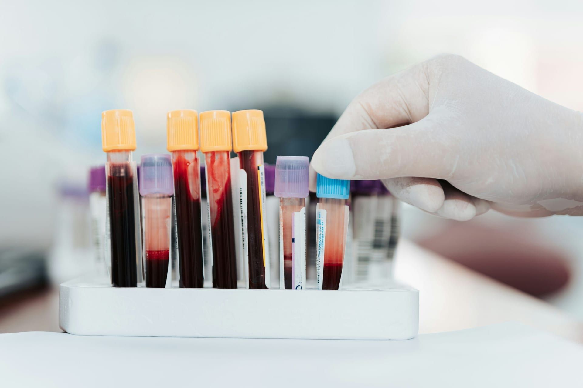Revolutionizing Early Detection: Gene Therapy, Blood Tests, and Biosensors Redefine Diagnostics