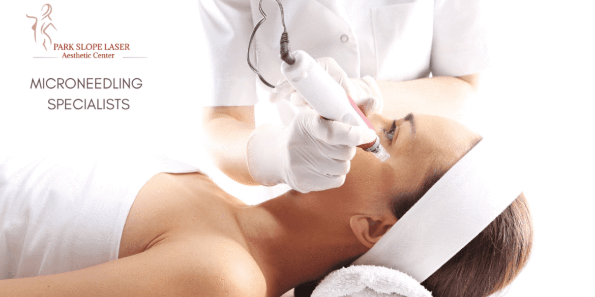 Microneedling